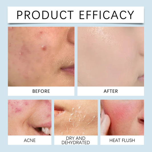 Hyaluronic Acid Face Serum Hydrating Radiant Skin