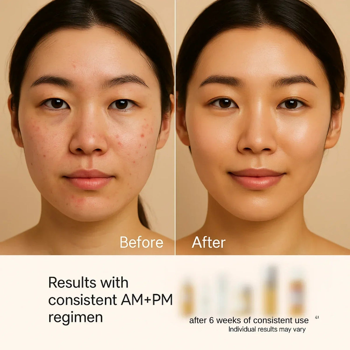 Full-Size Korean Skincare Set for Dark Spots, Fine Lines & Glass Skin